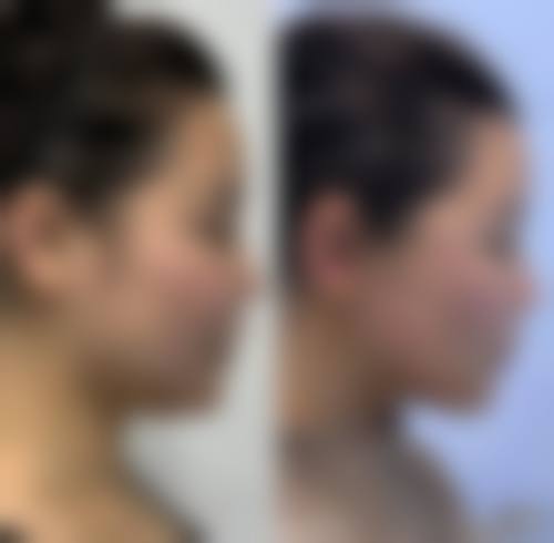 辽宁阜新市海州区柠勃整形门诊核心项目