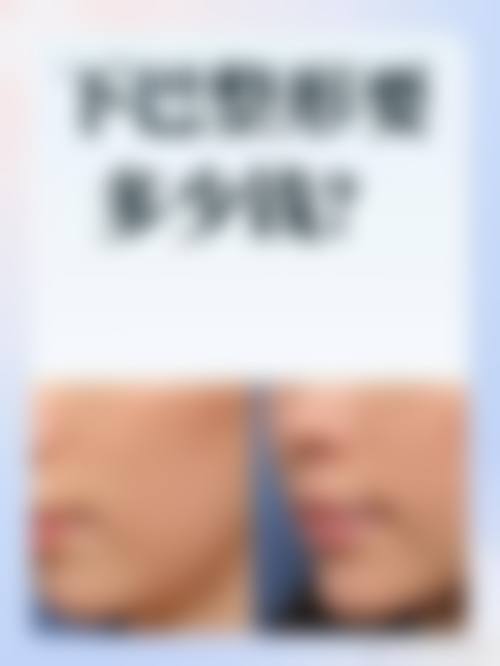 深圳张敏兰医疗整形美容诊所患者评价