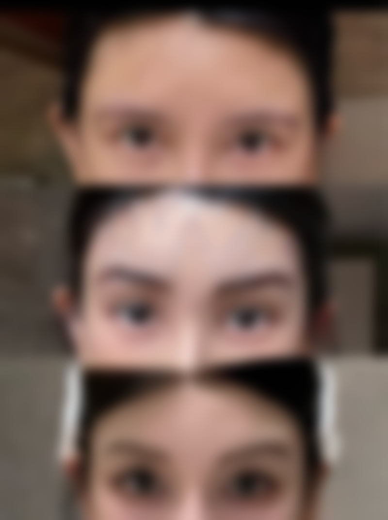 杭州昕微整形美容医院价格参考