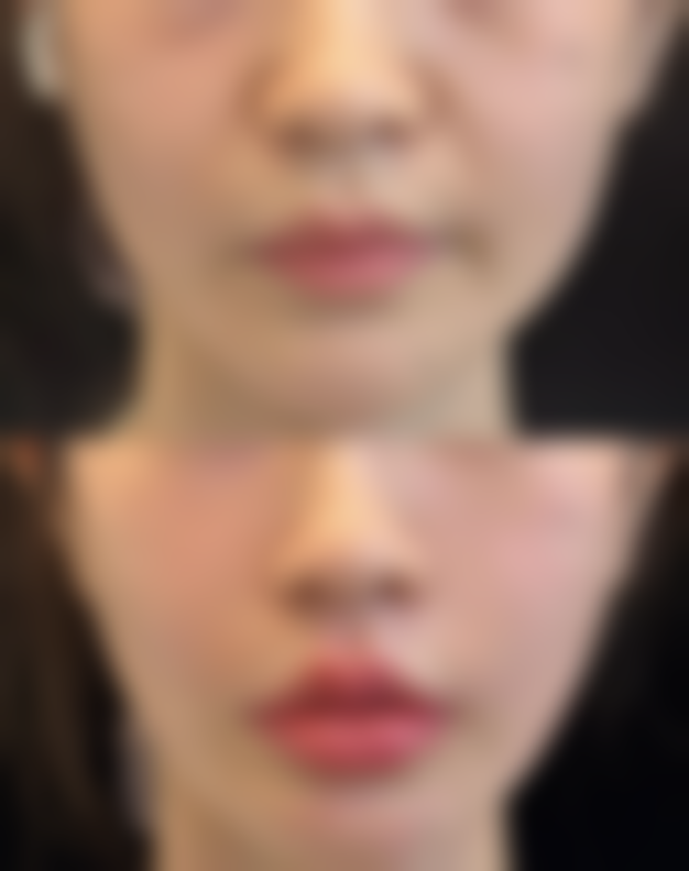 深圳康泰美整形医疗美容诊所患者评价