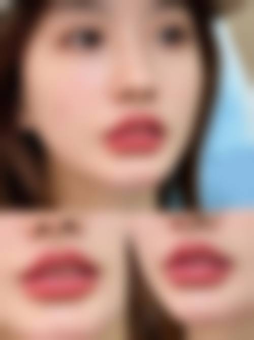 2024北京朗丽嘉整形医院价格参考