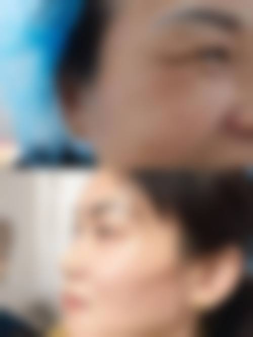 广州慕美整形医疗美容医院患者评价