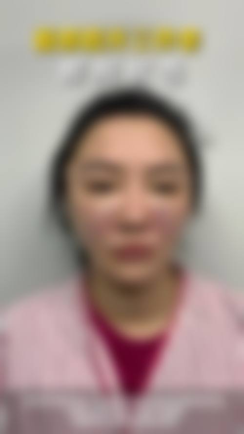 2026 广州慕美整形医疗美容医院价格参考