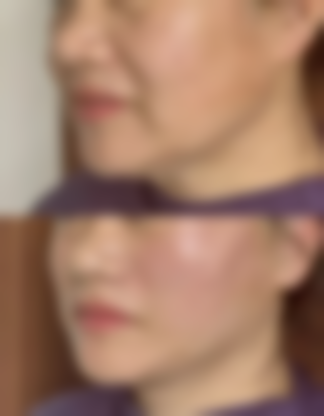 南通星小范医疗美容门诊部核心项目