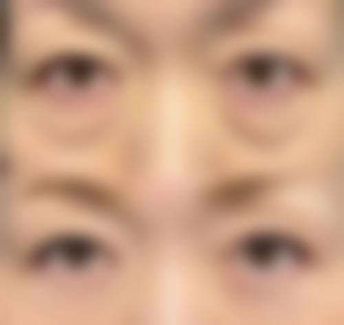 济南韩美整形医院患者评价