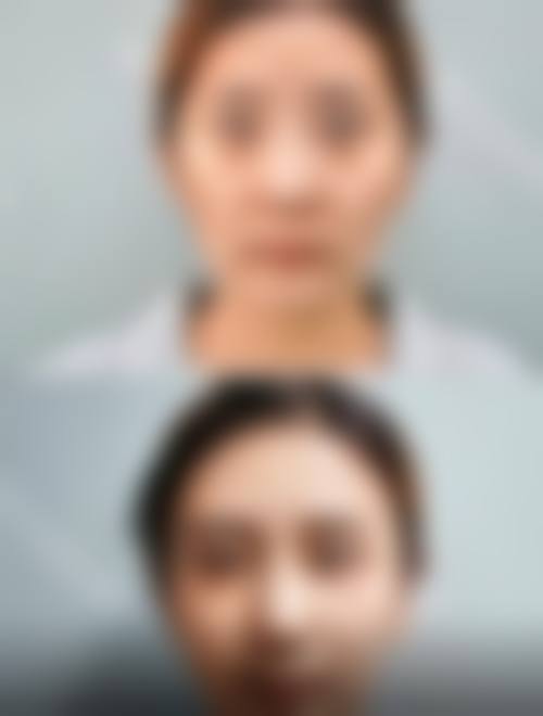 深圳星禾丽美整形医院患者评价