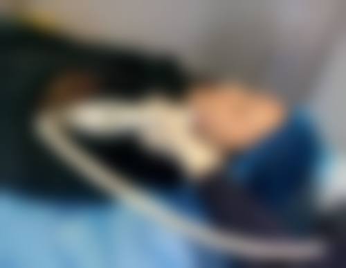 2026 西安橡皮擦医疗美容价格参考