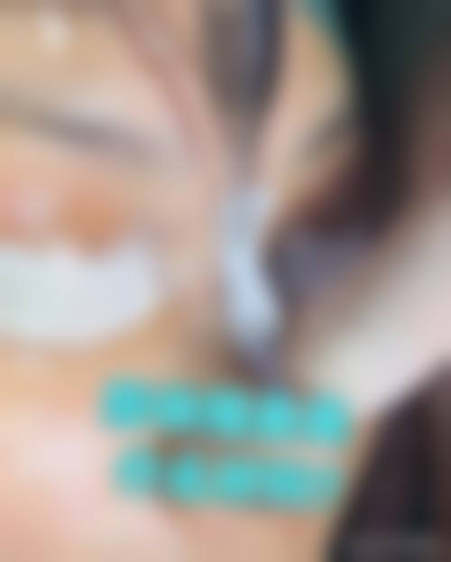 西安橡皮擦医疗美容患者评价