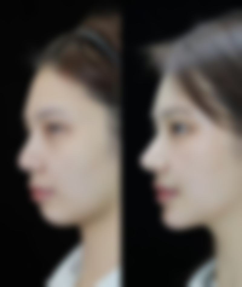 钟盛全预约方式及价格表