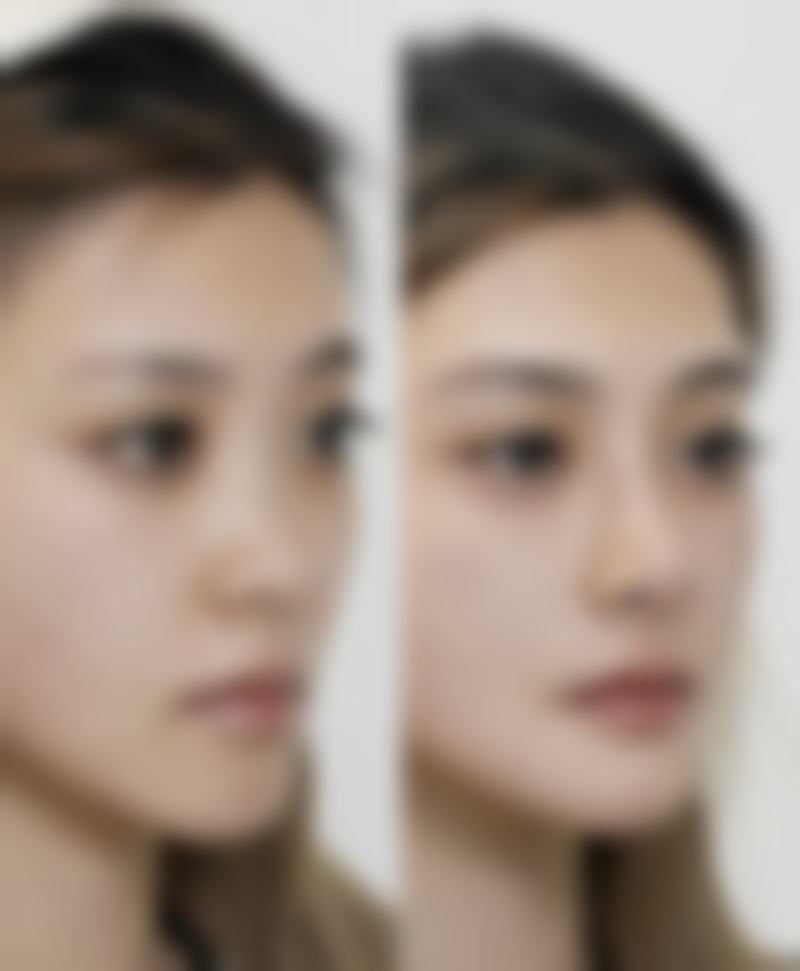 2026北京佰嘉利整形医疗美容价格参考