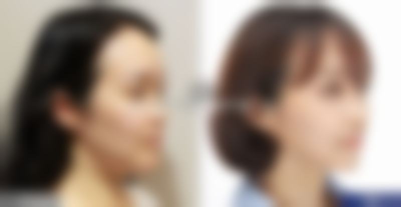 湖州妃凡整形医院患者评价