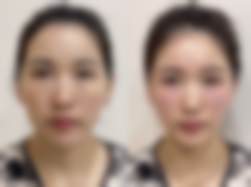 谢靓擅长项目列表