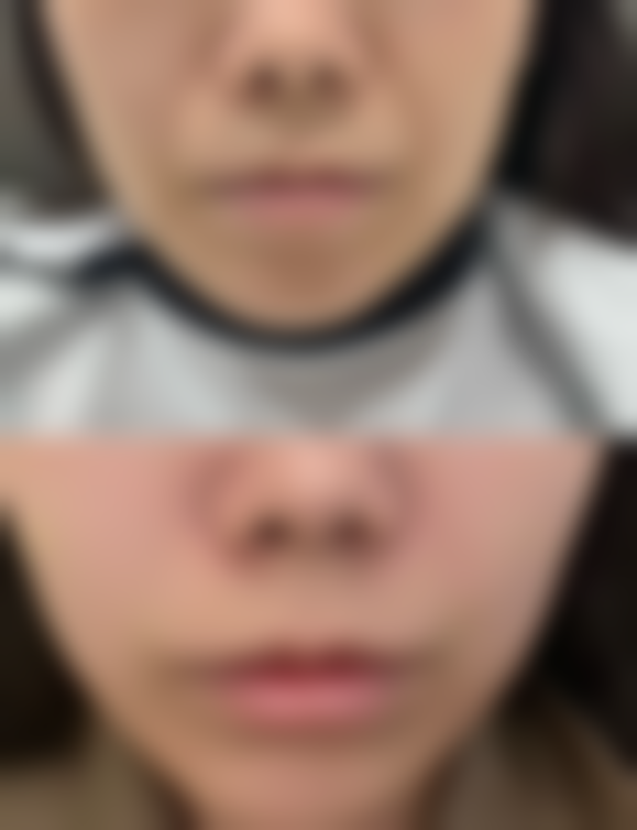 吴学田患者评价