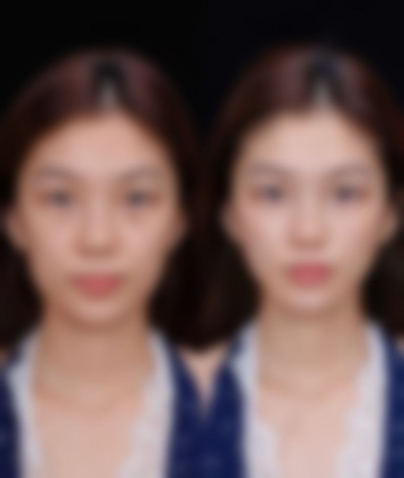 商丘柳志成医疗美容诊所核心项目