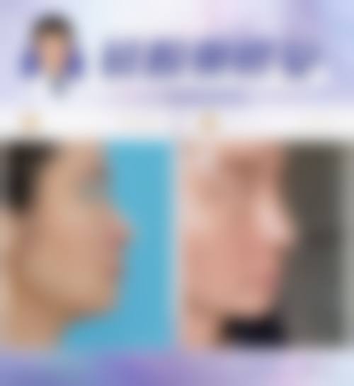 曾江技术水平评价