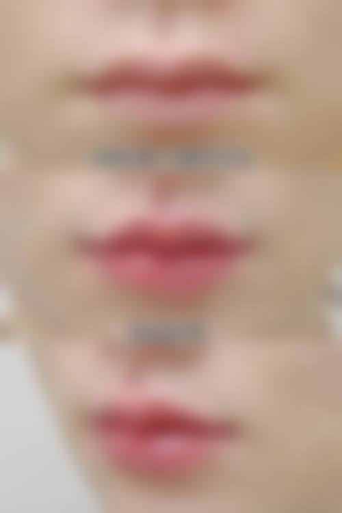 2026 徐州市第三人民医院价格参考