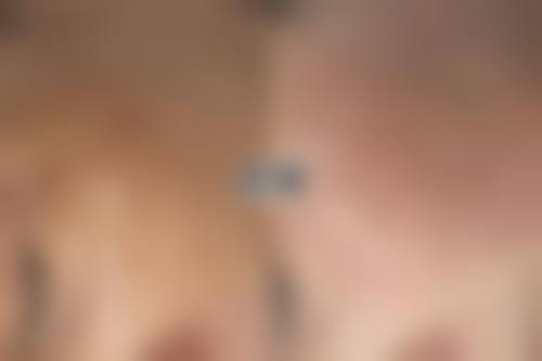 2026 榆林市第四 医院(烧伤整形显微外科（手足外科）)价格参考