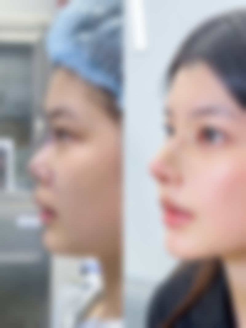 李咏红患者评价