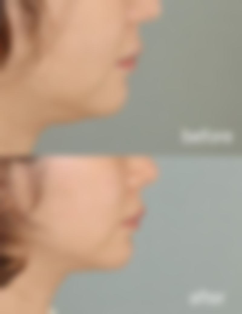 黄山艺美人医疗美容医院交通路线及预约