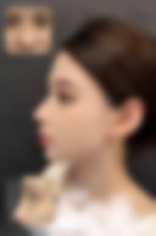 长沙如美（艾缇）医疗美容门诊部核心项目