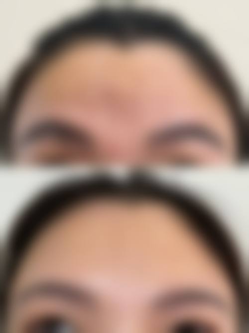 重庆非梵整形医院核心项目