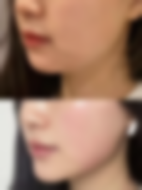 常德豆蔻年华整形医院核心项目