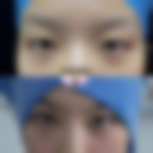 济宁格莱美医疗美容医院价格参考