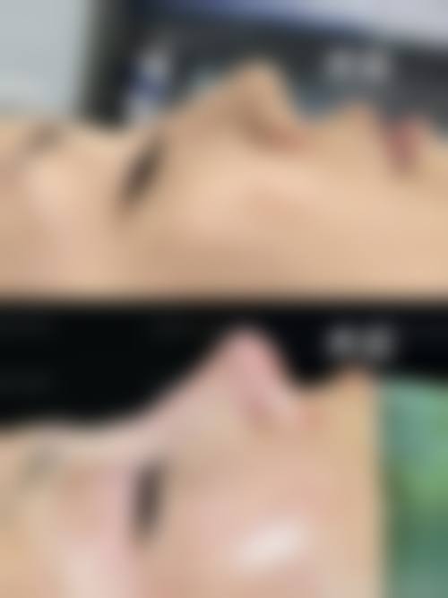 长沙润琪医疗整形美容门诊部核心项目