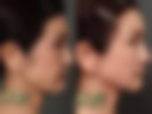 耒阳贝美医疗美容交通路线及预约