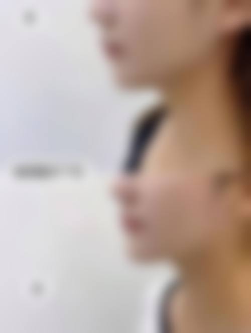 2026 无锡艾谜医疗美容门诊部价格参考