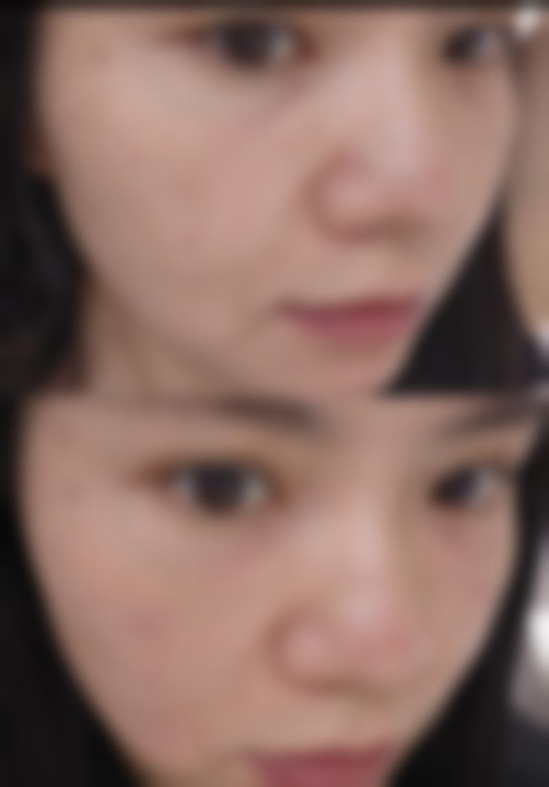 2026海口伊人整形美容诊所价格参考