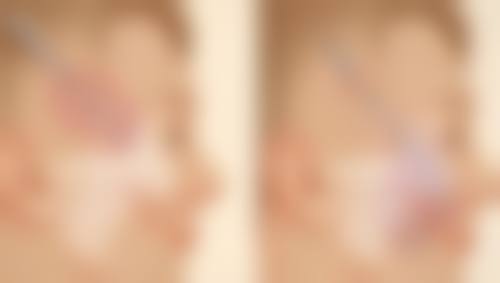 温州佑康和平整形医院核心项目