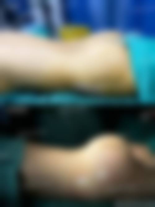 长沙美之峰医疗美容核心项目