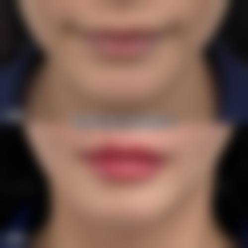 通江现黛整形美容医院核心项目