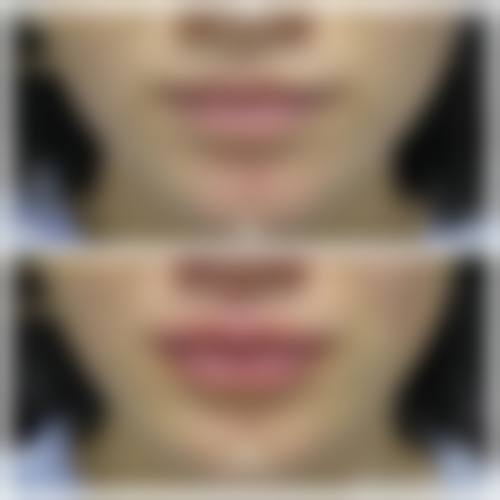 宣城仁爱医院整形烧伤外科交通路线及预约