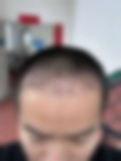 2026 上海明洞博尔医疗美容诊所价格参考