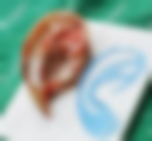 通江现黛整形美容医院患者评价