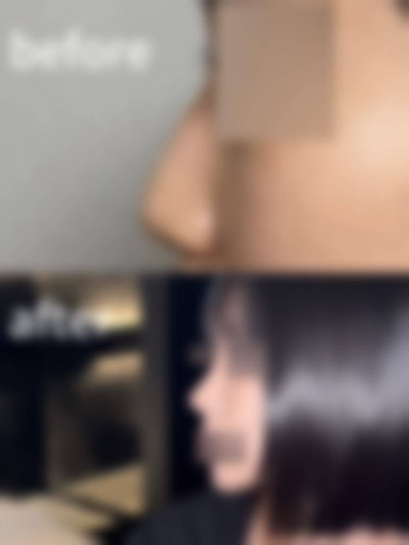 襄阳德尔美客整形患者评价