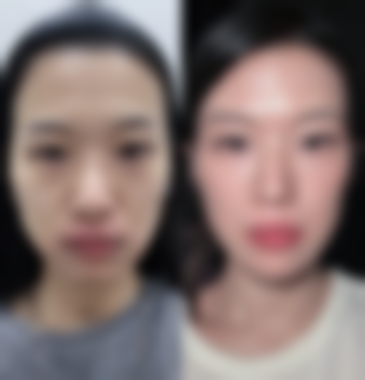 2026 襄阳德尔美客整形价格参考