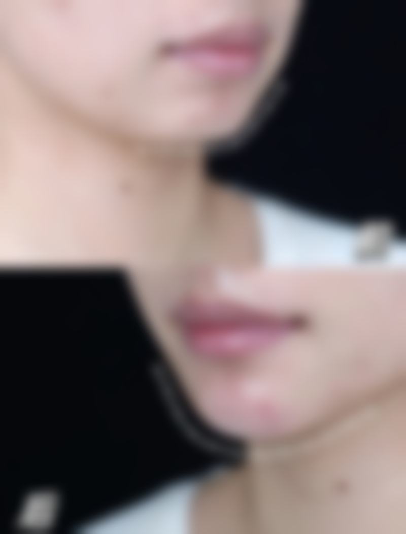 福州原肌美塑医疗美容诊所患者评价