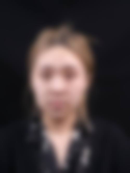 昆明颜晰整形医院患者评价