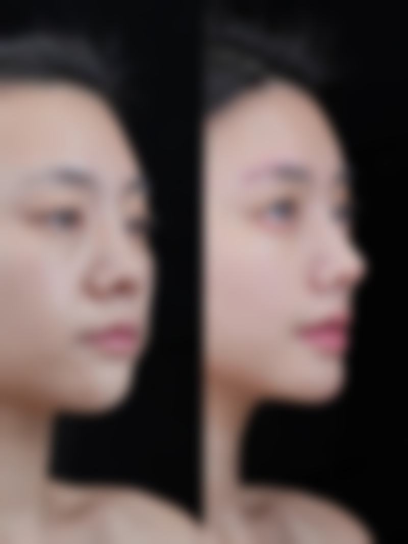 2026长沙美德思整形医院价格参考