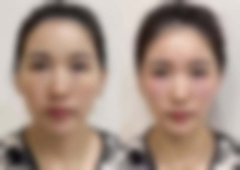 张家伟患者评价