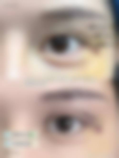 福建佰蓓医林整形医院核心项目