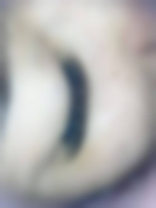 2026 韩国三个心愿3wishes整形（狎鸥亭店）价格参考