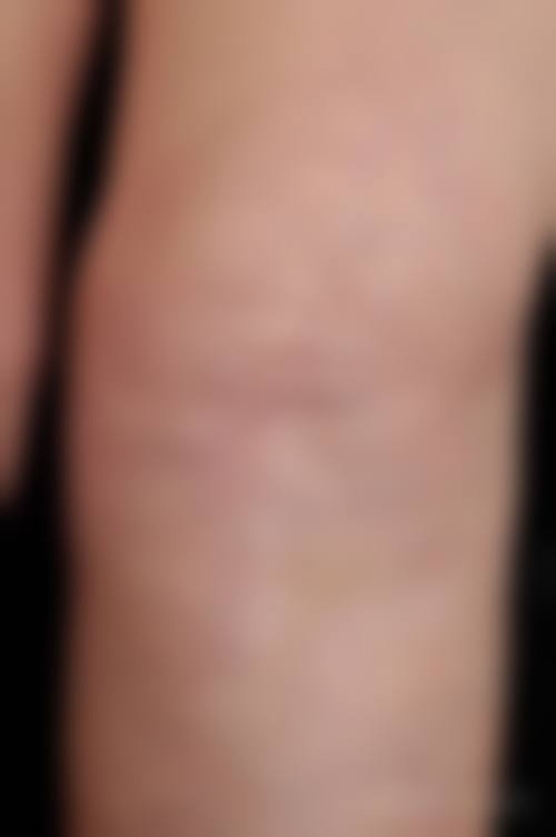 2026 开封市中 心医院整形美容科价格参考