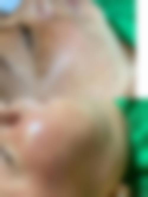 福建佰蓓医林整形医院患者评价