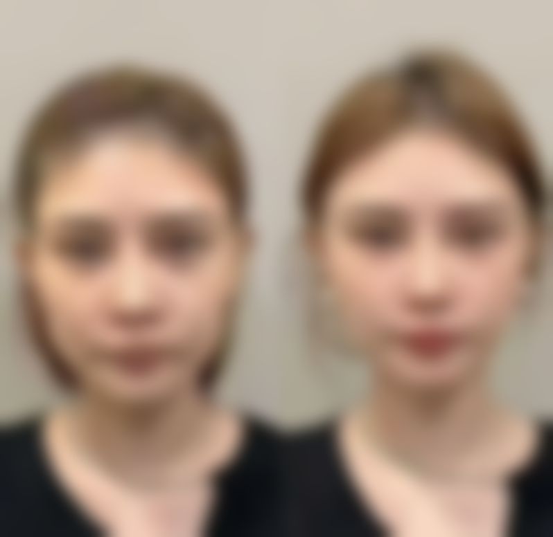 柏之叶皮肤科交通路线及预约