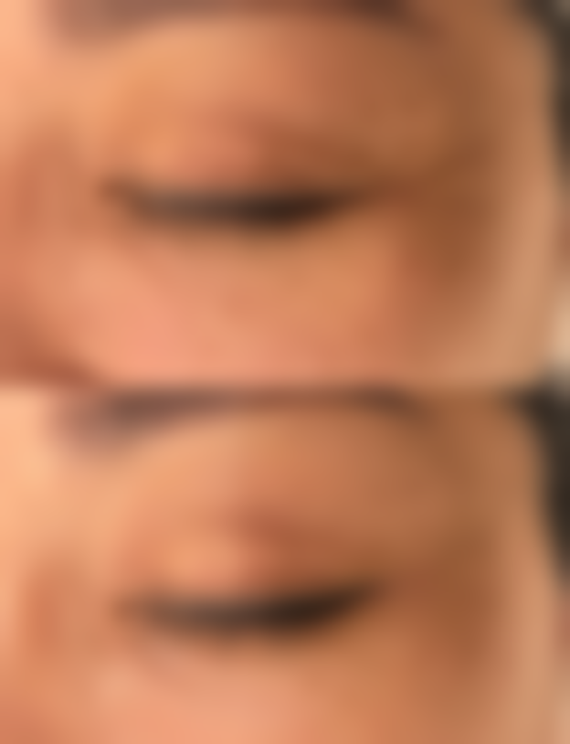 合肥中山医院整形美容科交通路线及预约