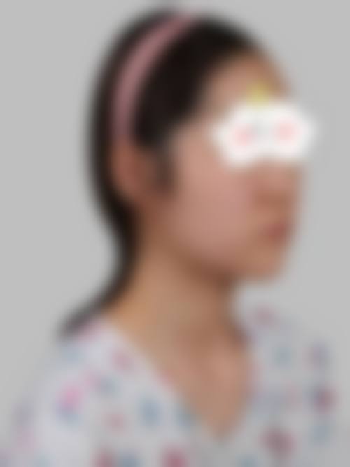 通辽市马皓整形医院患者评价